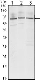 IHC-plus™ Monoclonal Mouse anti-Human IMP-3 / IGF2BP3 Antibody (clone 8F11, IHC, WB)