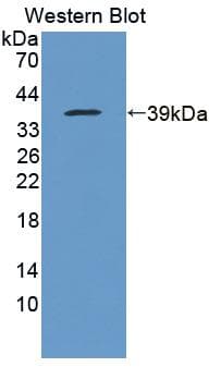 USP6NL Antibody (aa1-292)