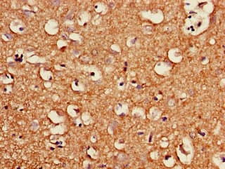 Polyclonal Rabbit anti-Human KV6.4 / KCNG4 Antibody (IHC, IF)