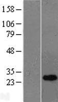 OIP5 Protein (Over-Expression Lysate Myc-DDK (Flag))