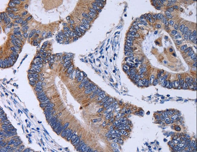 CA4 / Carbonic Anhydrase IV Antibody