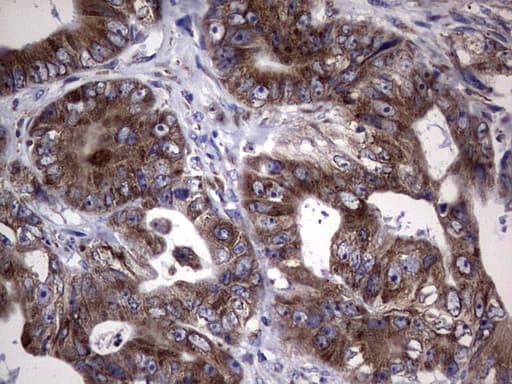 MTDH / Metadherin Antibody (aa70-582, clone OTI1B6)