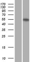 RARA / RAR Alpha Protein (Over-Expression Lysate Myc-DDK (Flag))