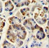 Polyclonal Rabbit anti-Human KCNJ6 / GIRK2 Antibody (aa26-55, IHC, WB)