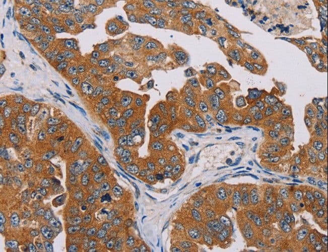 MBNL3 Antibody