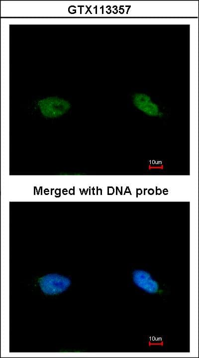 Polyclonal Rabbit anti-Human BCCIP Antibody (aa181-273, IHC, WB)