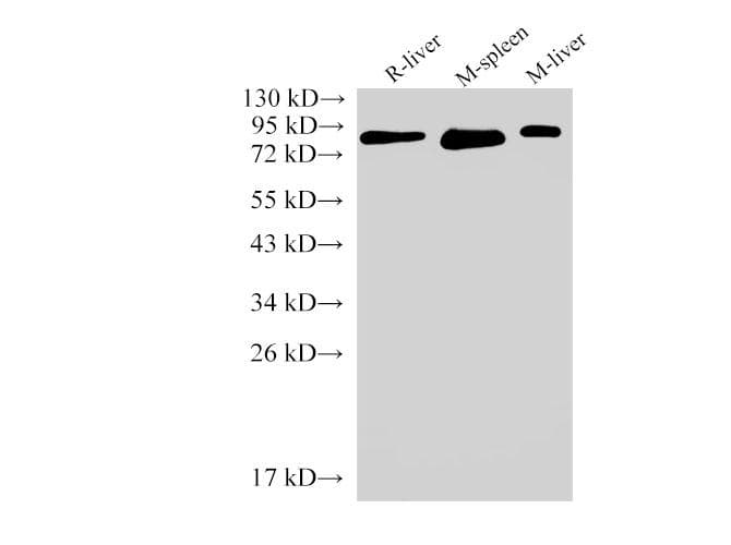 IL6R / IL6 Receptor Antibody