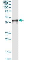 IHC-plus™ Monoclonal Mouse anti-Human CCN3 / NOV Antibody (clone 2G8, IHC, WB)