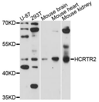 Polyclonal Rabbit anti-Human OX2R / Orexin Receptor 2 Antibody (WB)