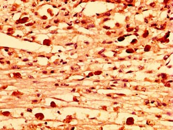 HUFI-2 / LRRFIP2 Antibody