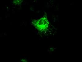 VEGFA / VEGF Antibody (clone OTI4E3)