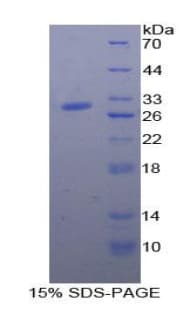 Human A2ML1 Protein (Recombinant His-T7)