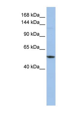 E4 / UBE4A Antibody (aa720-769)