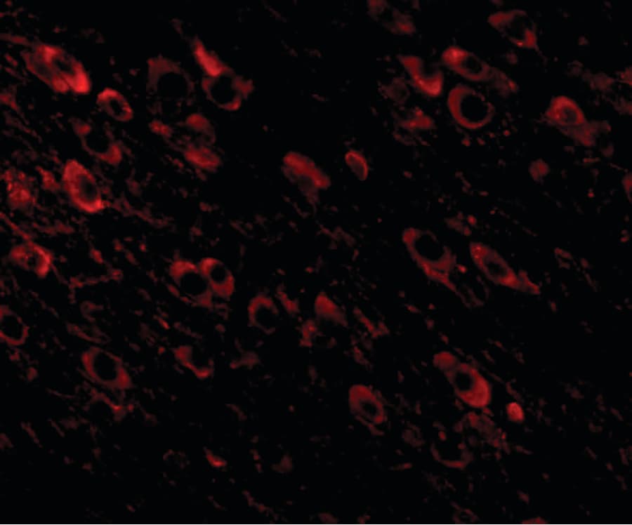 APP / Beta Amyloid Precursor Antibody
