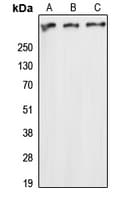 ATM Antibody (Internal)