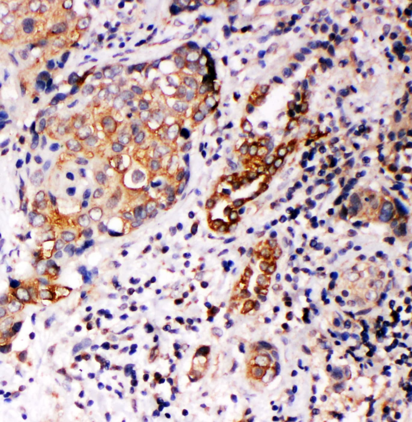 Polyclonal Rabbit anti-Human ANXA10 / Annexin A10 Antibody (aa308-324, IHC, WB)