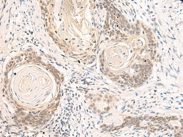 DPPA4 Antibody