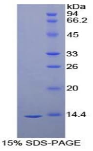 Human VEGFD Protein (Recombinant His)