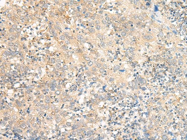 C5AR2 / GPR77 / C5L2 Antibody