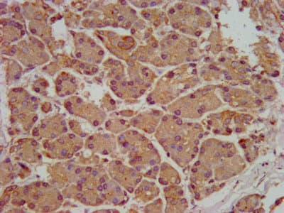 SMPD2 Antibody