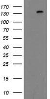 Monoclonal Mouse anti-Human ERBB2 / HER2 Antibody (clone OTI12G4, Carrier-free, aa676-1255, IHC, IF, WB)