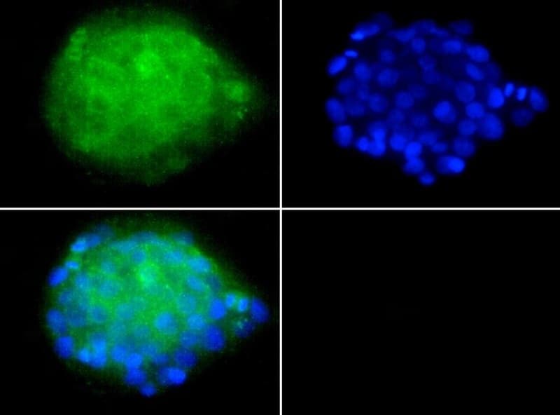 LDLR / LDL Receptor Antibody (clone C7, Biotin)