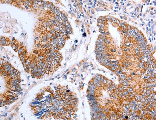 CLDN10 / Claudin 10 Antibody