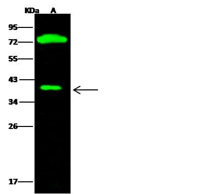 CTBS / CTB Antibody (Preservative Free)