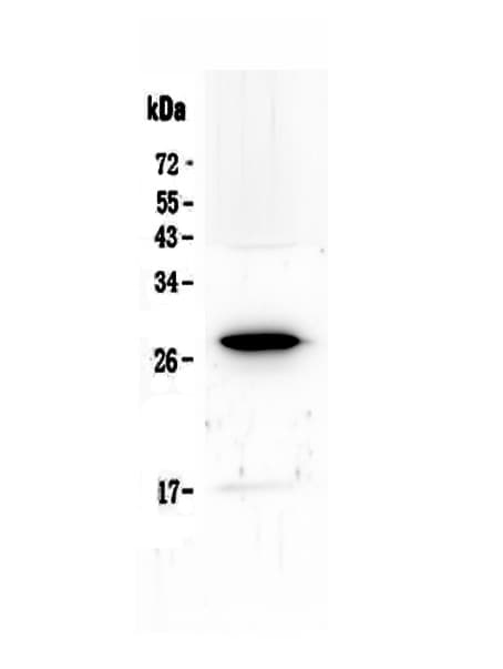 IL15RA Antibody