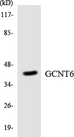 GCNT6 Antibody (aa188-237)