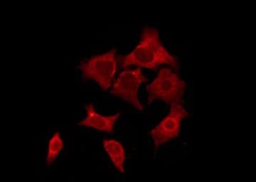 OR52E5 Antibody