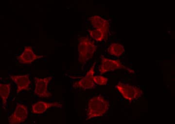 Polyclonal Rabbit anti-Human CSF1R / CD115 / FMS Antibody (phospho-Tyr809, IF, WB)