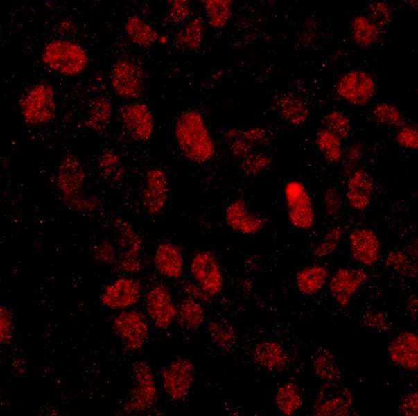 IHC-plus™ Polyclonal Rabbit anti-Human CPSF6 Antibody (aa501-551, IHC, IF)