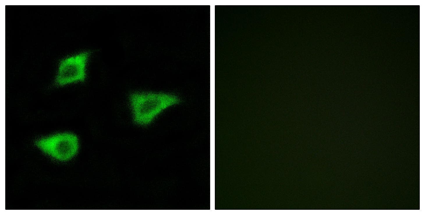CHRM4 / M4 Antibody