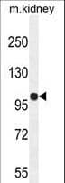 KIAA1324L Antibody (aa109-138)