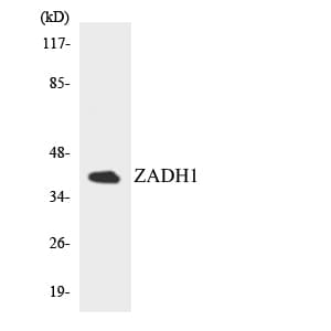 PTGR2 / PGR2 Antibody (aa169-218)