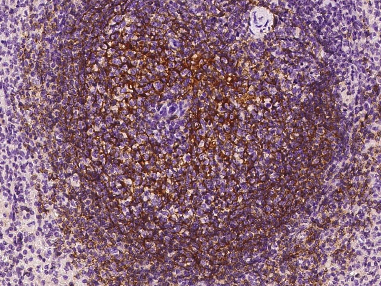 Polyclonal Rabbit anti-Human CR2 / CD21 Antibody (Preservative Free, IHC, WB)