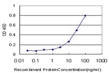 TIMP1 Antibody (clone 4D12)