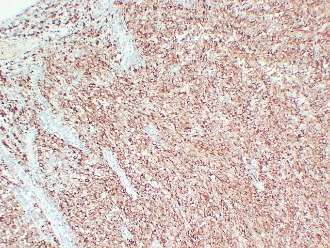 Monoclonal Mouse anti-Human Tyrosinase Antibody (clone ABT-TYR, IHC)