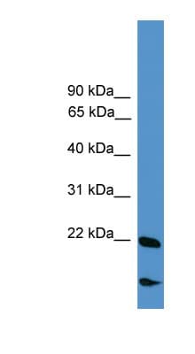 RBM18 Antibody (aa101-150)