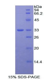 Rat INSR / Insulin Receptor Protein (Recombinant His)