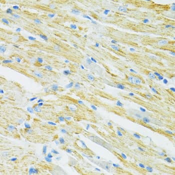 Polyclonal Rabbit anti-Human SLC19A1 Antibody (IHC, WB)