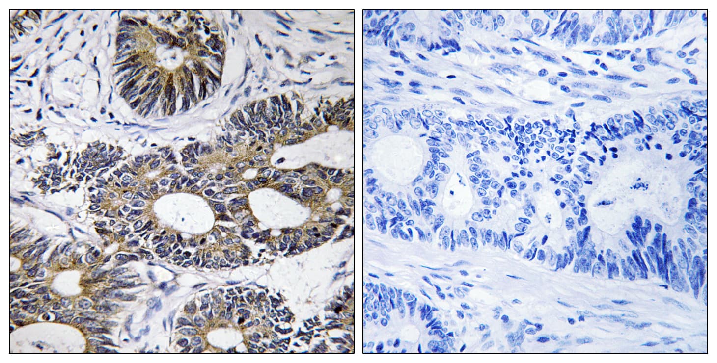 EIF1AY Antibody (aa21-70)