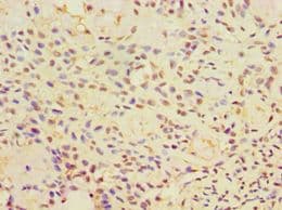 CALR3 Antibody (aa135-384)