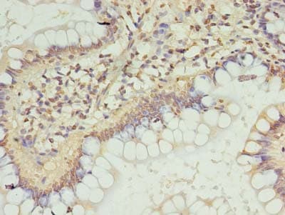 Polyclonal Rabbit anti-Human ZC3H12A / MCPIP1 Antibody (IHC)