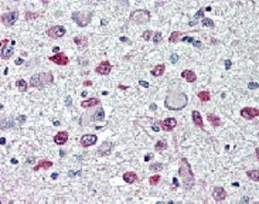 Monoclonal Mouse anti-Human FTO Antibody (clone AG103, IHC, WB)