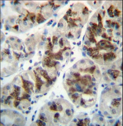 CTGF Antibody (aa166-193)
