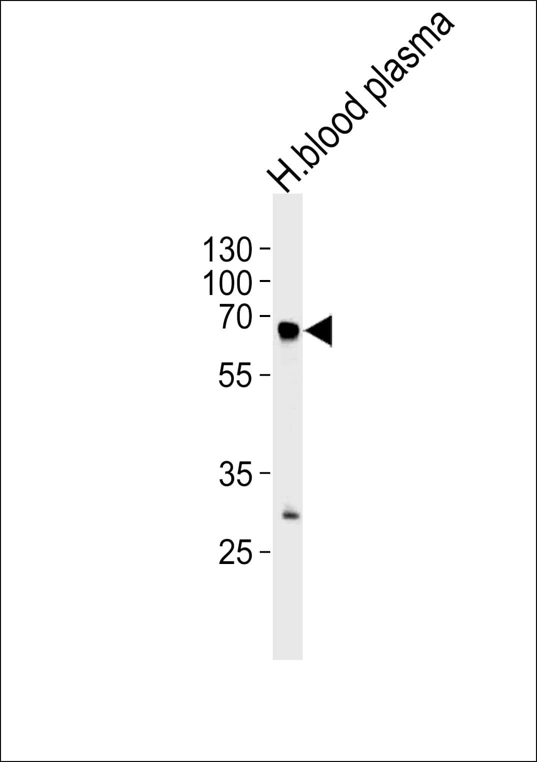FGA / Fibrinogen Alpha Antibody (aa116-144)