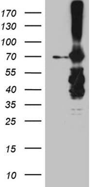 METTL3 Antibody (aa1-284, clone OTI1B7)