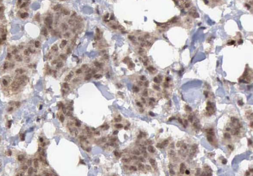 Polyclonal Rabbit anti-Human p14ARF / CDKN2A Antibody (IHC, IF, WB)